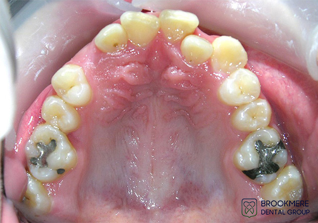 Orthodontics Dental Treatment