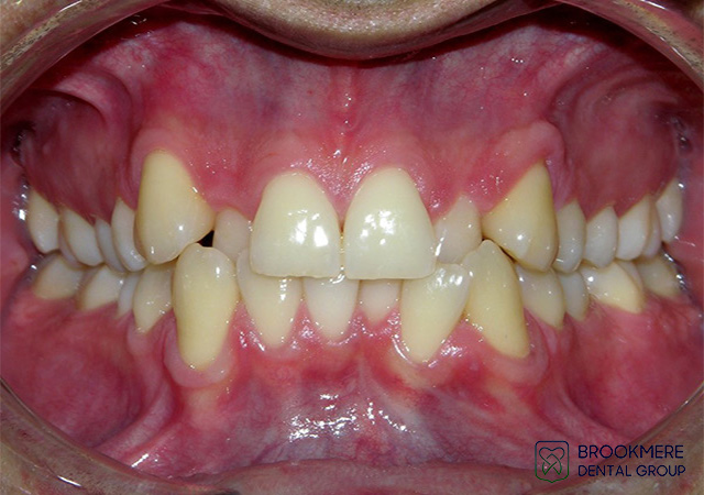 Before and After Dental Treatment Photos