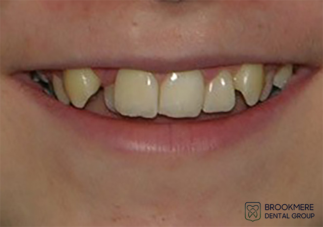 Dental Treatment Photos
