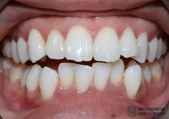 Before and After Dental Treatment Photos