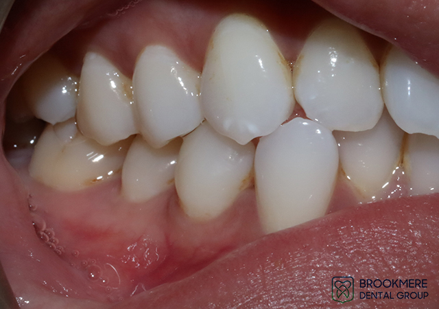 Dental Treatment Photos