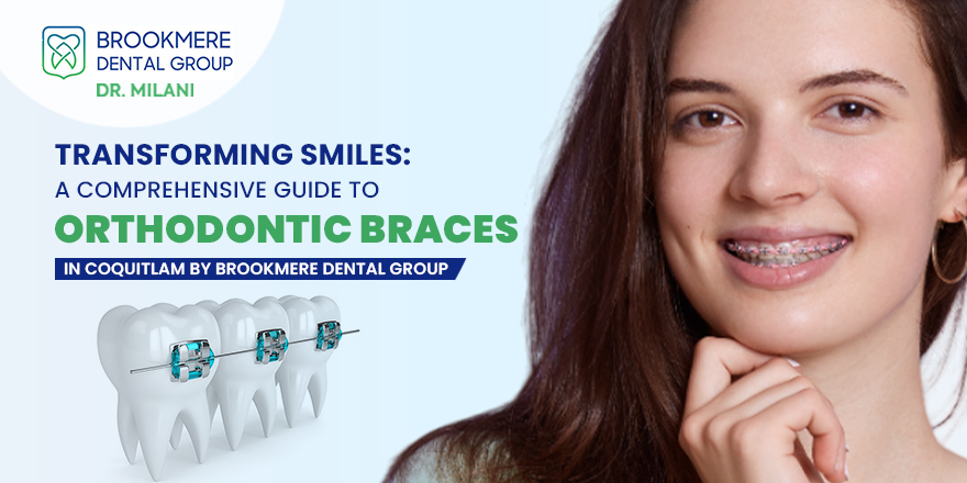 What are dental braces? : A Complete Guide