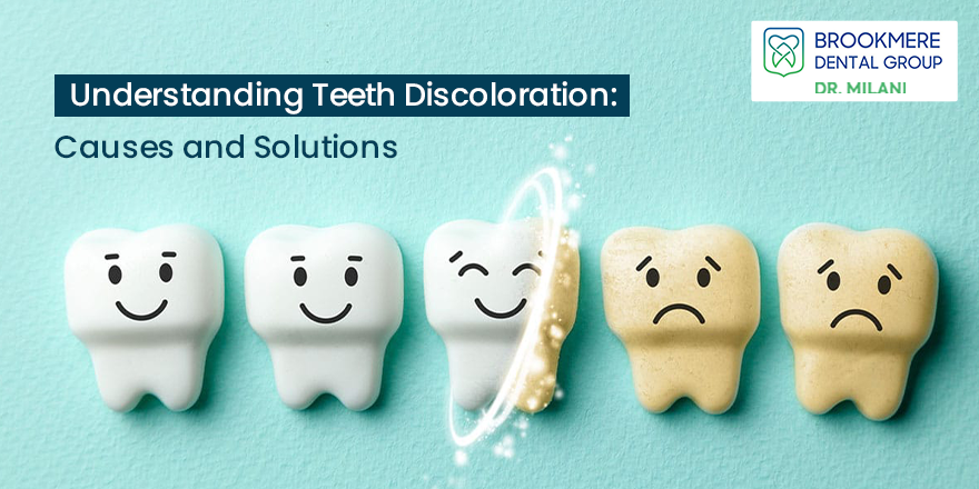 Understanding Teeth Discoloration: Causes and Solutions