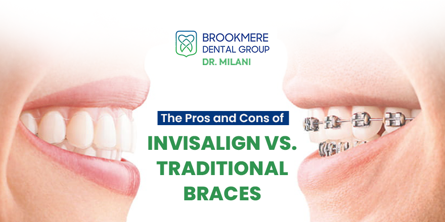 The Pros and Cons of Invisalign vs. Traditional Braces