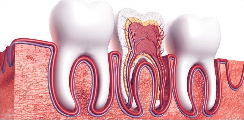 Root-Canal-Therpay