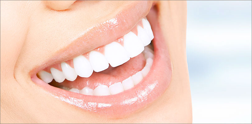 Teeth-Whitening